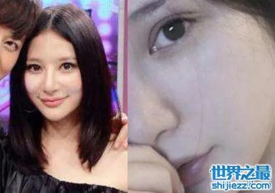 熊乃瑾整容前后照片对比，清新女神整容失败香肠嘴 