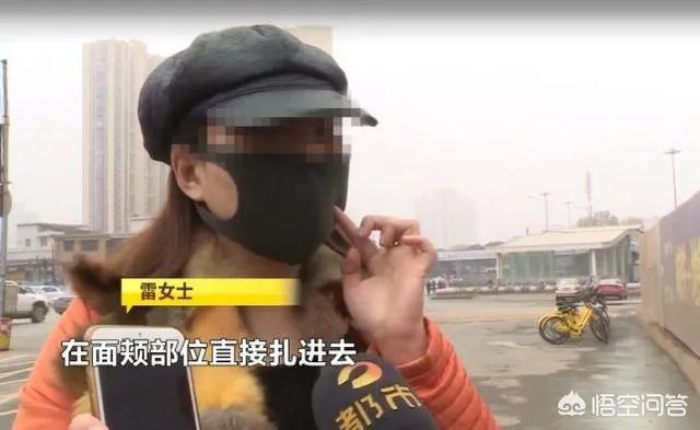 如何看待长沙女子脸部整容整出八个坑,恢复期要很久?