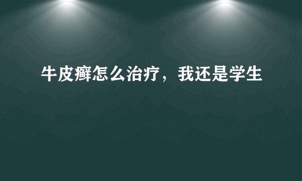牛皮癣怎么治疗，我还是学生