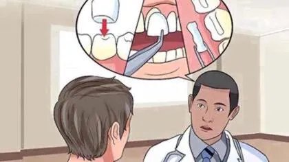 如何修复牙釉质