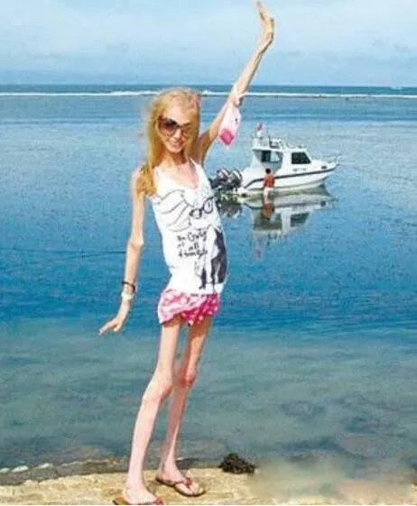世界上最瘦的女人是谁 kseniya bubenko皮包骨头的图片