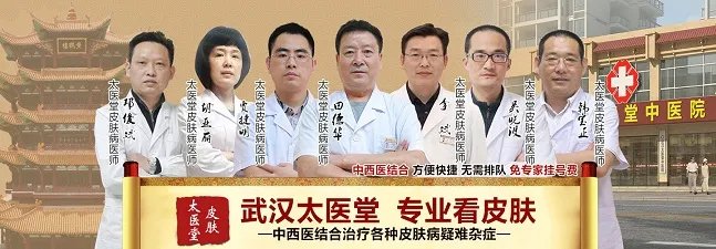 武汉中医治疗青春痘