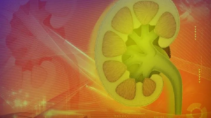 肾结石形成的原因有哪些呢