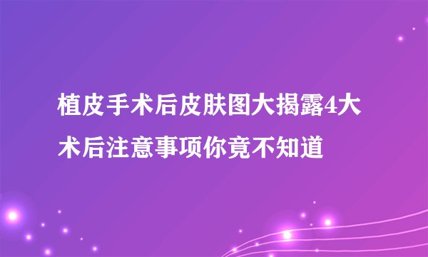植皮手术后皮肤图大揭露4大术后注意事项你竟不知道