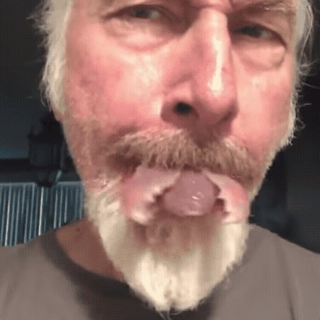 国外男子手术将自己的舌头变成蚂蚁舌 被恶心到了！