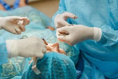 做了全切双眼皮要多久恢复