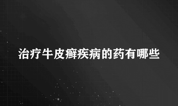 治疗牛皮癣疾病的药有哪些