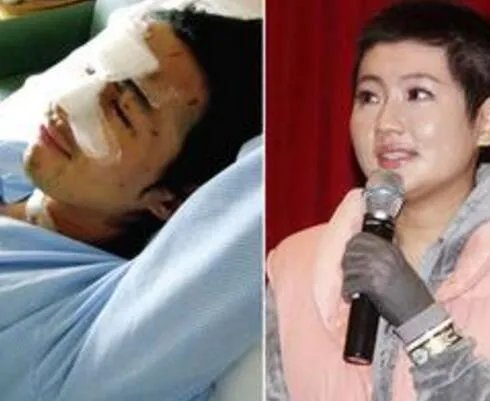 selina烧伤事件原因盘点 其烧伤惊人内幕