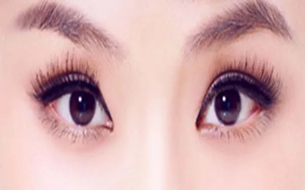 苏州开眼角哪家整形医院好