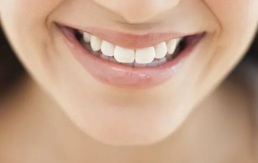 垫下巴多久消肿