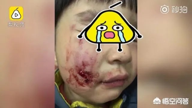 2岁娃等电梯时遭邻居3只狗迎面扑咬出血，事发8天后狗主人不露面不道歉，你怎么看？