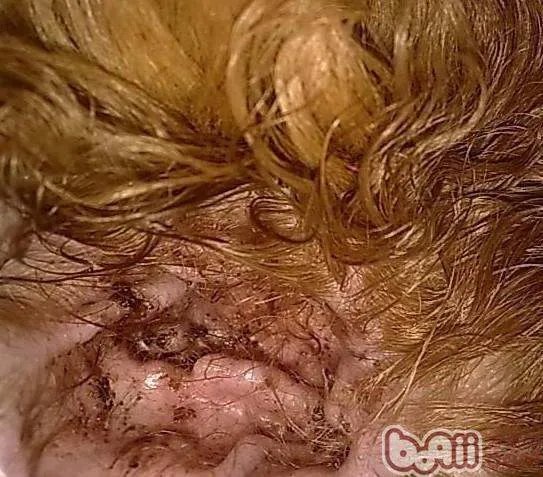 狗狗耳螨在家怎么治疗