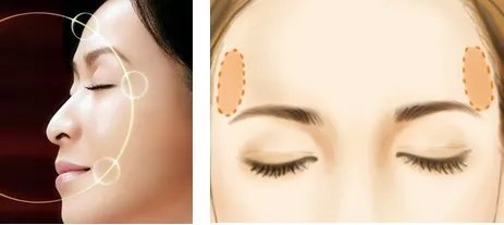 成都什么医院丰太阳穴好？