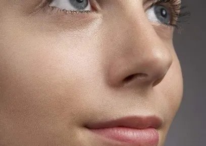 激光去斑要多少钱啊