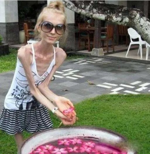 世界上最瘦的女人是谁 kseniya bubenko皮包骨头的图片