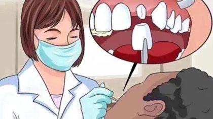 如何修复牙釉质