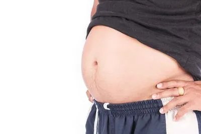 减重手术适合哪些肥胖患者？