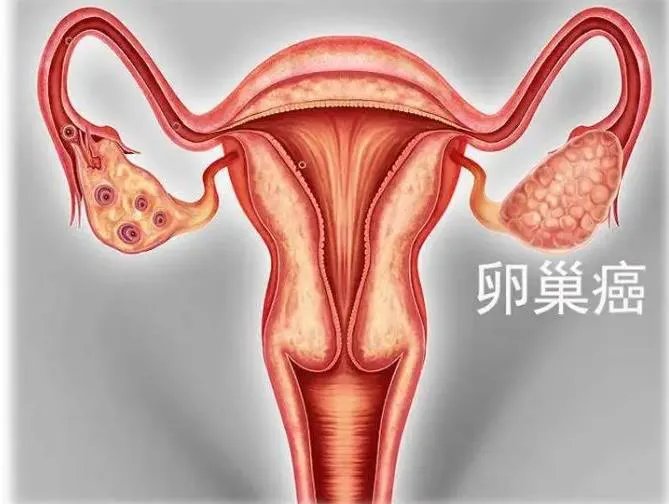 柬埔寨试管婴儿价格一览表，看看做试管需要多少钱