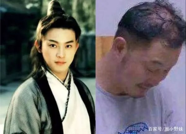 吴彦祖陷秃顶危机，黄晓明最意外， 5位遭遇“头发危机”的男明星都有谁？