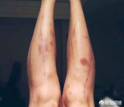 昔日的“洪荒少女”傅园慧现在做什么?还在做游泳运动员吗?