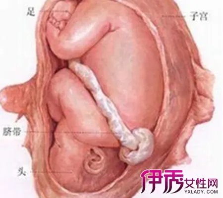 怀孕六个月胎儿位置图