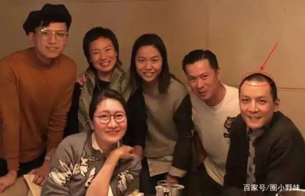 吴彦祖陷秃顶危机，黄晓明最意外， 5位遭遇“头发危机”的男明星都有谁？