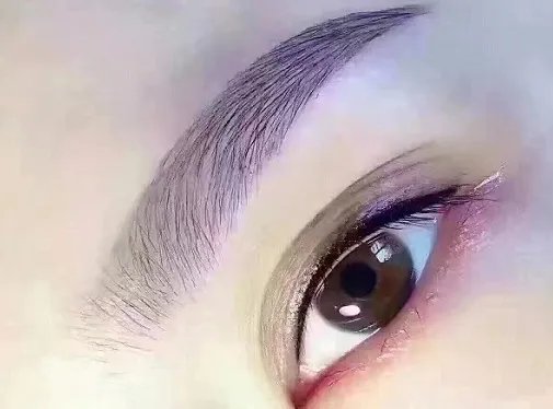 一般开眼角多长时间恢复自然