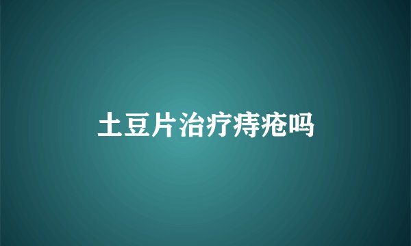 土豆片治疗痔疮吗