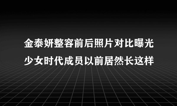 金泰妍整容前后照片对比曝光少女时代成员以前居然长这样