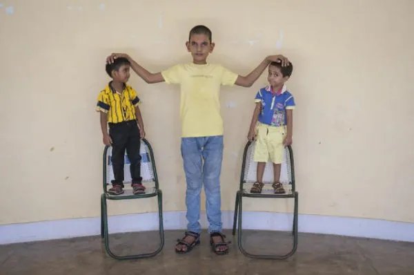 14岁男孩身高2.21米挑战吉尼斯纪录,你觉得是好是坏?