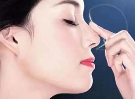 注射隆鼻后注意什么