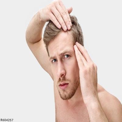 头皮长疙瘩是什么原因 揪出头皮长疙瘩的4个原因