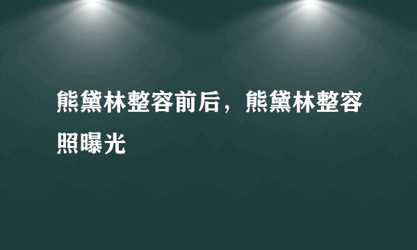 熊黛林整容前后，熊黛林整容照曝光