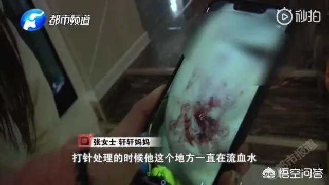 2岁娃等电梯时遭邻居3只狗迎面扑咬出血，事发8天后狗主人不露面不道歉，你怎么看？
