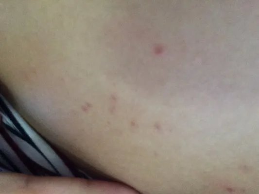 过敏什么症状图片