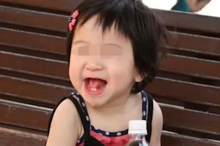 天使综合征婴儿期图片