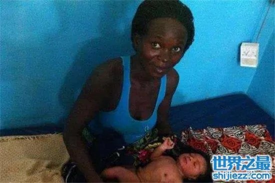 世界上最黑的孩子，一起来看一下最黑的孩子的出生和现状！ ... 