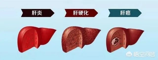 臧天朔去世是因为什么病?