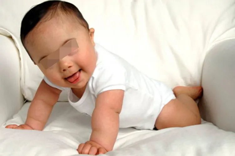 天使综合征婴儿期图片