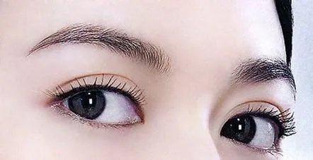 双眼皮埋线跟割哪个好