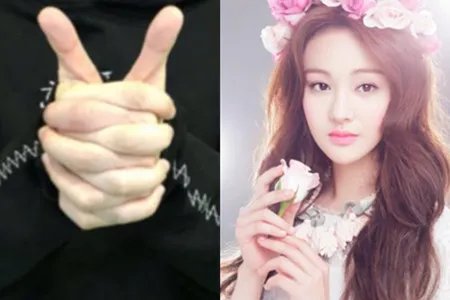 郑爽受伤后首亮相 敬业精神被称赞