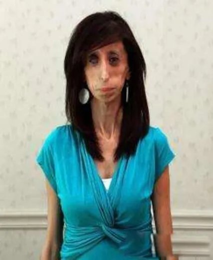 世界上最瘦的女人是谁 kseniya bubenko皮包骨头的图片