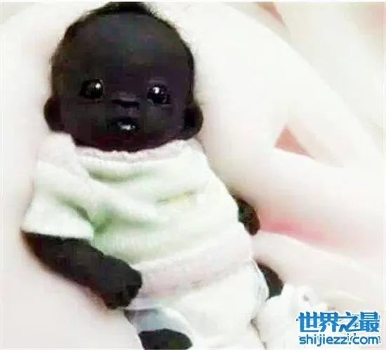 世界上最黑的孩子，一起来看一下最黑的孩子的出生和现状！ ... 