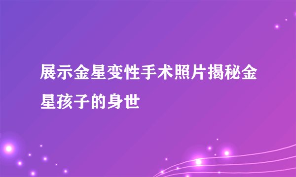 展示金星变性手术照片揭秘金星孩子的身世
