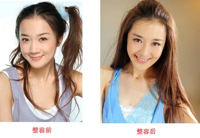 李依晓整容前后对比图 李依晓的胸围有多大