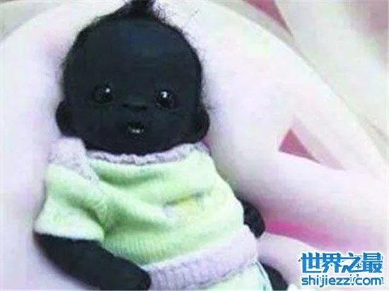 世界上最黑的孩子，一起来看一下最黑的孩子的出生和现状！ ... 
