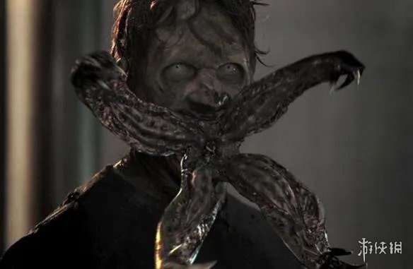 国外男子手术将自己的舌头变成蚂蚁舌 被恶心到了！