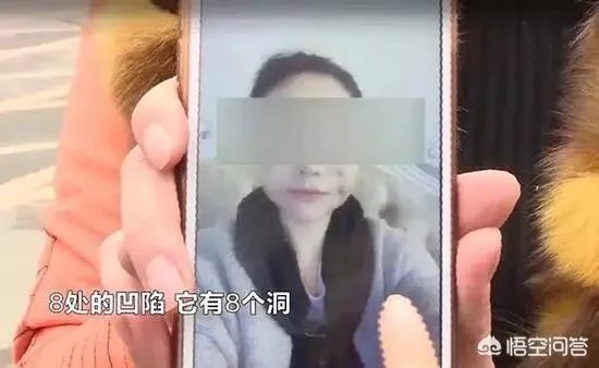 如何看待长沙女子脸部整容整出八个坑,恢复期要很久?