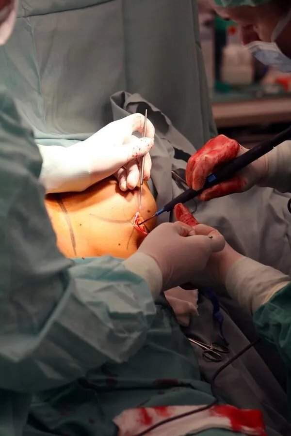 北京丰胸费用多少钱