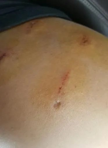 游客在八达岭野生动物园猛兽区开窗投食，被黑熊咬伤手臂，你怎么看？